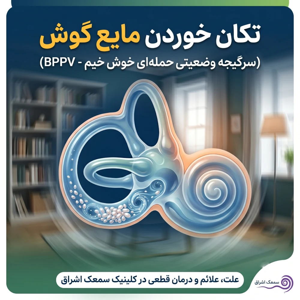 تکان خوردن مایع گوش