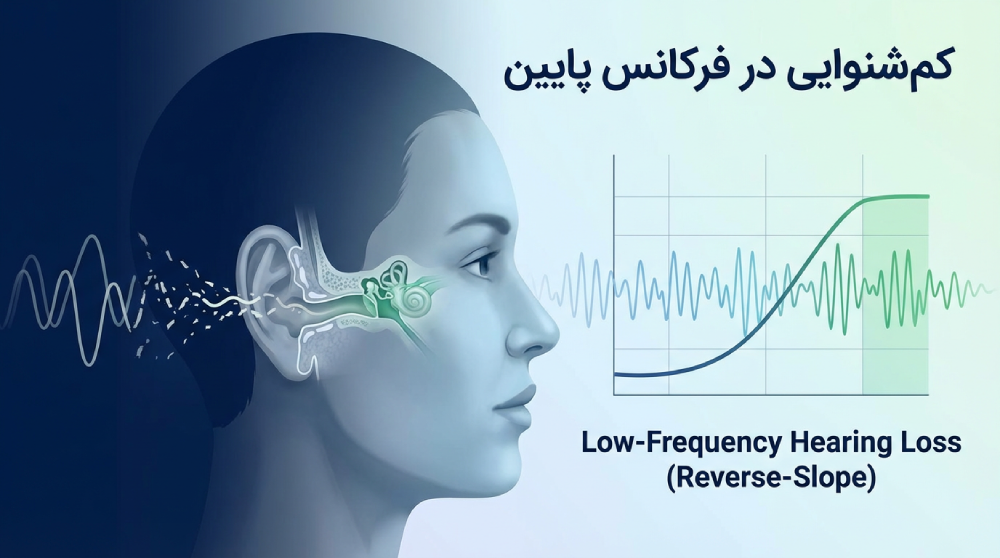 کم شنوایی در فرکانس پایین