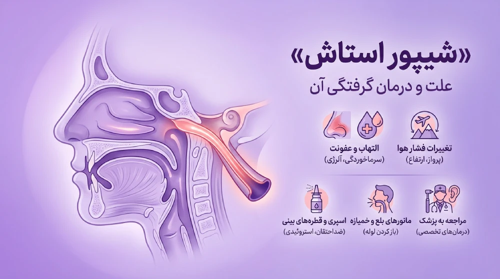 شیپور استاش چیست؟