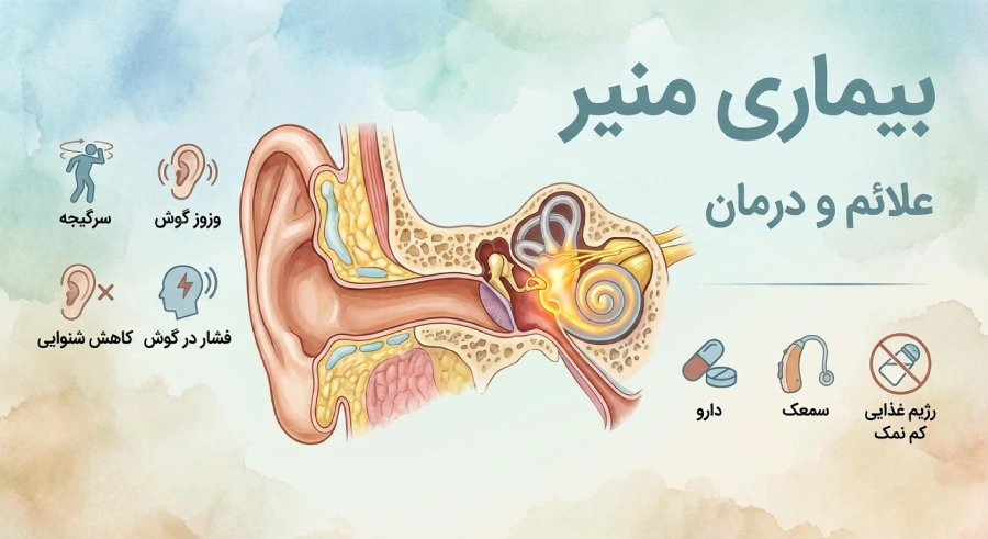 بیماری منییر