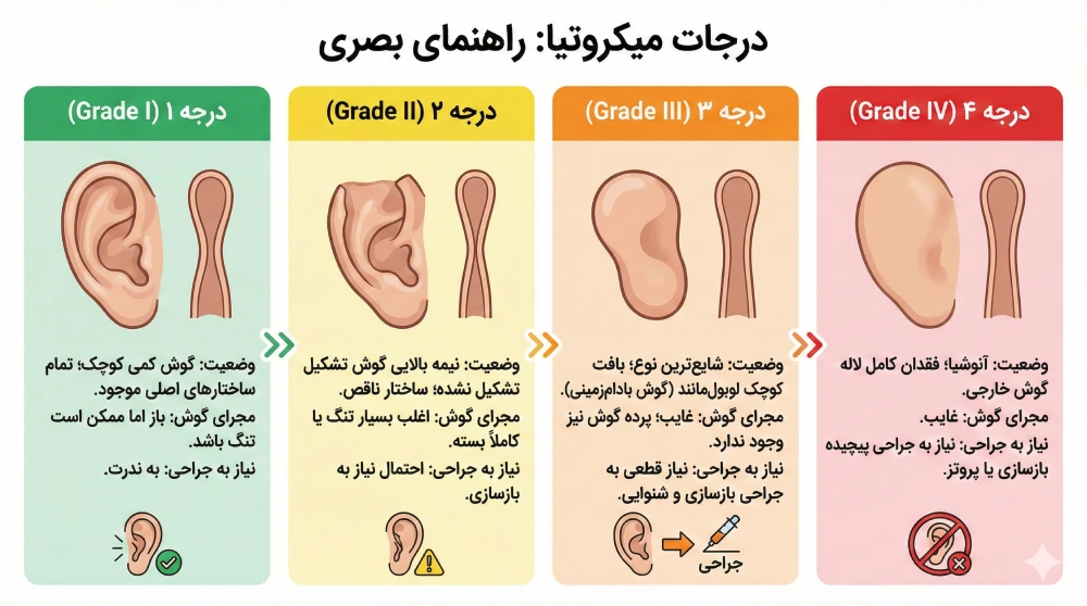 میکروتیا چیست؟ (آشنایی با درجات مختلف بدشکلی لاله گوش)