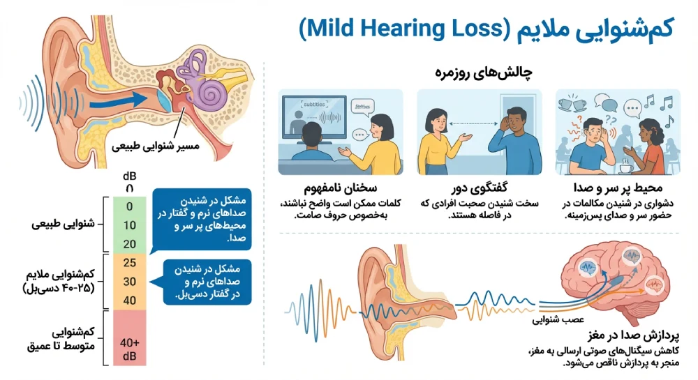 کم شنوایی ملایم چیست