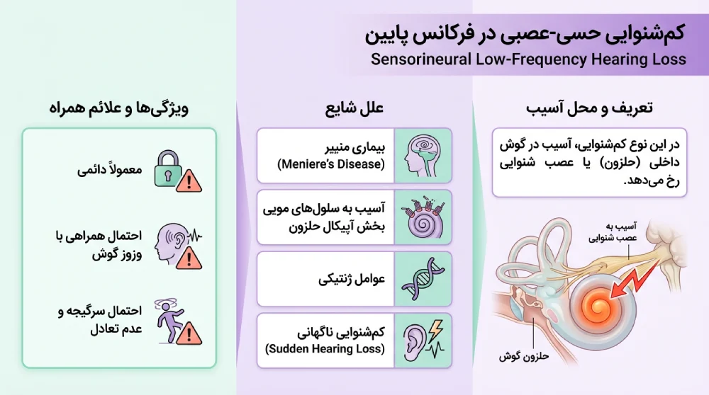 کم شنوایی حسی-عصبی در فرکانس پایین