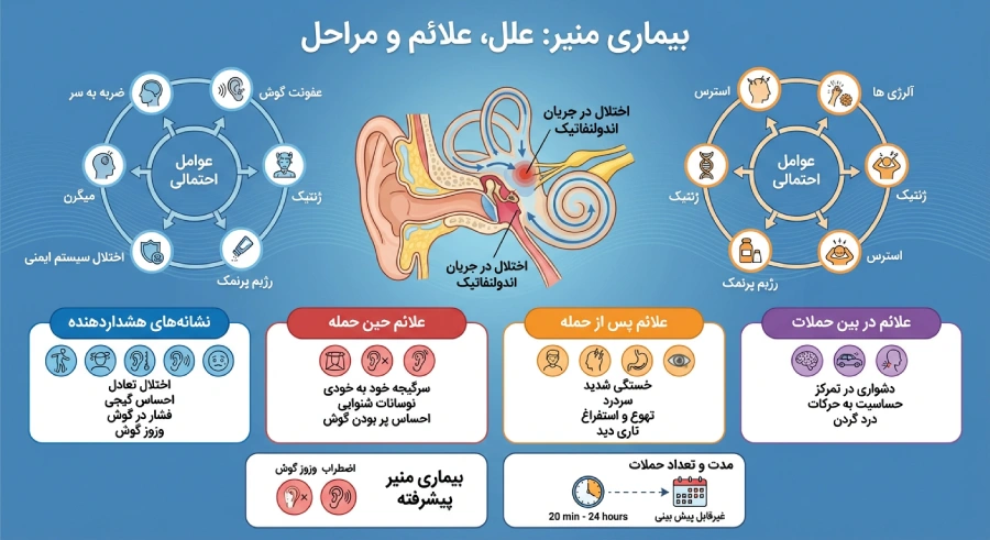 چه چیزی باعث بیماری منیر میشود؟