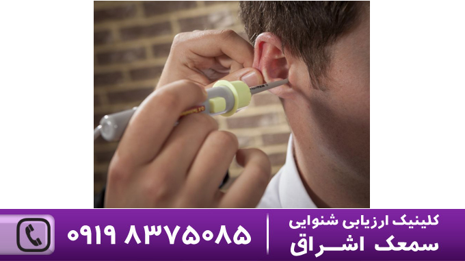 درمان گوش درد توسط دکتر